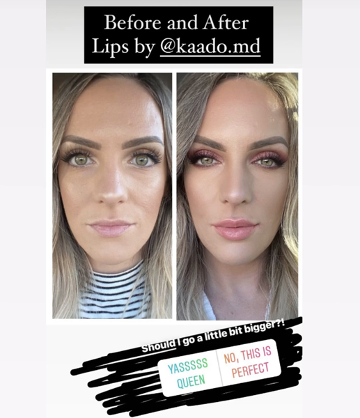 Reviews, Kaado Aesthetics & Anti-Aging