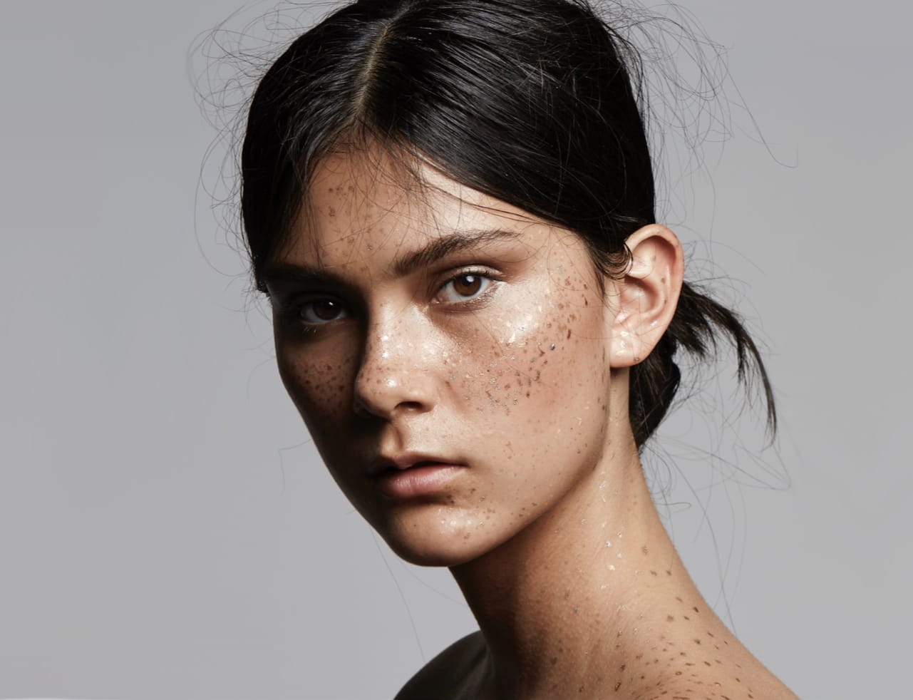 IPL Treatment, Kaado Aesthetics & Anti-Aging Medicine